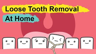 How To Pull Out A Loose Tooth At Home [upl. by Geerts901]