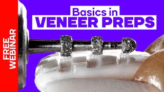 Basic principles in veneer preps FREE Webinar [upl. by Skyler]