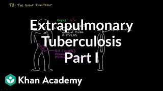 Extrapulmonary TB part 1  Infectious diseases  NCLEXRN  Khan Academy [upl. by Sennahoj467]