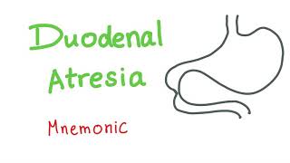 Duodenal Atresia Mnemonic [upl. by Celio188]