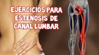 Ejercicios para ESTENOSIS DE CANAL LUMBAR [upl. by Ibbed]