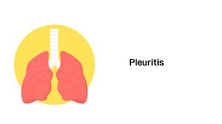 Rippenfellentzündung Pleuritis  Erkrankungen der Atemwege [upl. by Aihsenak]