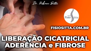 MASSAGEM de LIBERAÇÃO CICATRICIAL PREVENÇÃO ADERÊNCIA FIBROSE Clínica Fisioterapia Dr Robson Sitta [upl. by Ecylla850]