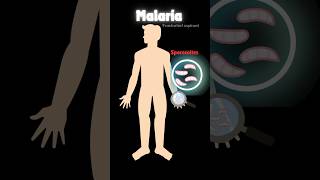 Malaria amp life cycle of plasmodium 🦟 neetbiology humanhealthanddisease neet pw viralshorts [upl. by Hollingsworth]