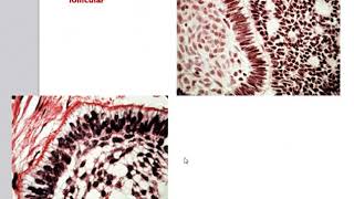 Odontogenic Tumors [upl. by Walliw912]