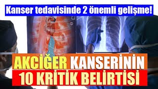 AKCİĞER KANSERİNİN 10 BELİRTİSİ Akciğer kanseri tedavisinde 2 önemli gelişme [upl. by Siskind511]