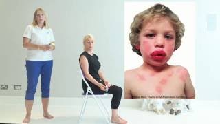 Top Tips for Anaphylaxis  First Aid [upl. by Romonda]