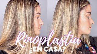 RINOPLASTIA CASERA EN 1 MINUTO 😱 RESPINGADOR DE NARIZ  RINOPLASTIA SIN CIRUGIA [upl. by Sherj566]