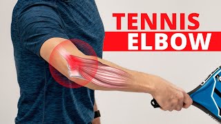 Tennis Elbow Try this 5Min Routine [upl. by Yecies]