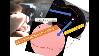 Darting motility of bacteria Positive Vibrio cholerae Campylobacter jejuni [upl. by Ninnahc999]