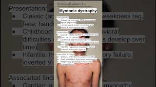 Myotonic dystrophy [upl. by Browne]