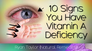 10 Common Signs of Vitamin A Deficiency [upl. by Wanfried]