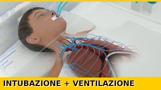 Intubazione Endotracheale e Ventilazione Meccanica in 3D [upl. by Nealah]