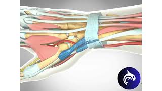 Quick View  De Quervain’s Tenosynovitis Release  3D Animation [upl. by Chuck]