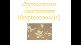 Cryptococcus neoformans I Cryptococcosis I Medical mycosis I Medical microbiology I [upl. by Anayeek]