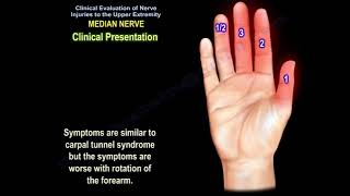 Median nerve injury causes symptoms diagnosis and treatment Carpal tunnel syndrome diagnosis [upl. by Annayhs996]