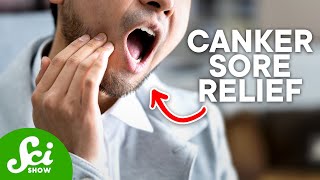 How to Get Rid of Canker Sores According to Science [upl. by Enelram]