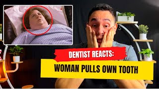 Dentist Reacts to Woman Pulling Her Own Teeth [upl. by Lladnik870]