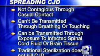 WingBeating Tremor in CreutzfeldtJakob Disease CJD [upl. by Naillimxam]