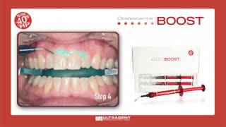 Ultradent Opalescence Boost Whitening [upl. by Luther]