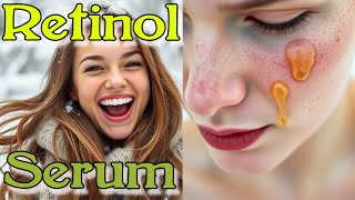 7 Days to Flawless Skin👌DIY Retinol Serum to Erase Wrinkles Acne amp Dark Spots [upl. by Eniamej]