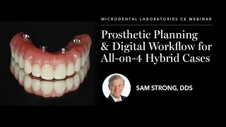 Sam Strong — Prosthetic Planning amp Digital Workflow for Allon4 Hybrid Cases [upl. by Inge]