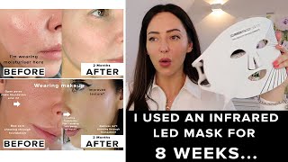 I used the CurrentBody LED Mask for 8 weeks amp this happened [upl. by Pages]