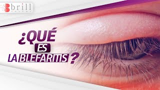 ▶ BLEFARITIS 👀🔥 ¿Qué es esta Enfermedad que provoca Inflamación y Rojez en los párpados [upl. by Niko416]