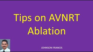 Tips on AVNRT Ablation [upl. by Chilton72]