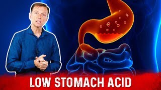 The Best Way To Know If You Have Low Stomach Acid – DrBerg [upl. by Pritchard]