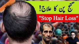 Dr ZeeHow to Regrow Hair the Two Causes of Hair Loss  डॉक्टर ज़ी [upl. by Itch]