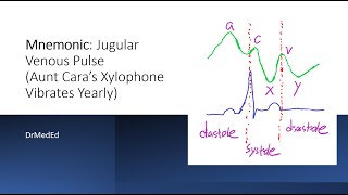 Mnemonic Jugular Venous Pulse Waveform Aunt Caras Xylophone Vibrates Yearly [upl. by Anirtap]