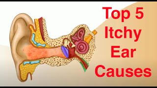 Top 5 Causes of Itchy Ears and Treatment Too [upl. by Gerita]