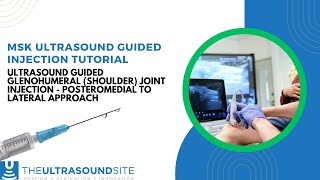 Ultrasound guided glenohumeral shoulder joint injection  posteromedial to lateral approach [upl. by Aitercal]