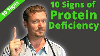 10 Hidden Signs of PROTEIN Deficiency Watch Carefully 2024 [upl. by Swann]