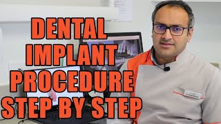 Dental Implants Procedure Step by Step  How Dental Implants are Put In  Dental Implant Surgery [upl. by Jarrell]