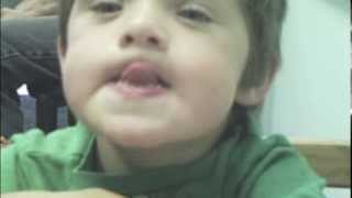 Dariens Journey with Childhood Apraxia of Speech [upl. by Nylirret466]