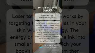 Tattoo Removal FAQs by Tampa Bay Tattoo Removal [upl. by Udale131]