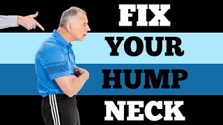 Single Best Fix 6 Min for Neck Hump Buffalo Hump [upl. by Rillings]