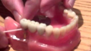 Correct way to floss a dental implant by Periodontal Associates [upl. by Ydnagrub]