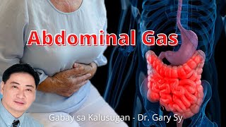 Abdominal Gas  Dr Gary Sy [upl. by Coy]