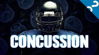 Explain it to me Concussions [upl. by Sholeen]