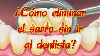 Como eliminar el sarro de los dientes sin ir al dentista [upl. by Billie]