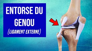 Entorse du genou Ligament Externe  Les Traitements [upl. by Reinal]