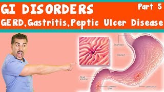 GI Disorders GERD Gastritis peptic ulcer Disease Part 5 [upl. by Arodasi]