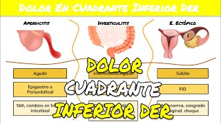 ⚕️🩺 DOLOR EN LADO DERECHO DEL ABDOMEN  Apendicitis o Diverticulitis o Embarazo Ectópico [upl. by Anned446]