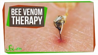 The Problem with Bee Venom Therapy [upl. by Naamann]