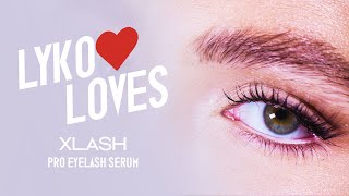 Lyko Loves  Xlash [upl. by Lev864]