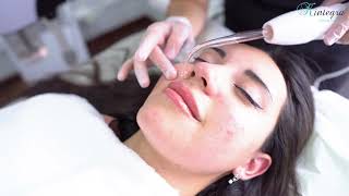 Limpieza Facial Profunda Profesional [upl. by Llenrub]