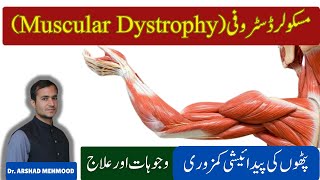 Duchenne Muscular Dystrophy DMD Symptoms Diagnosis Treatment amp Management  Muscular dystrophy [upl. by Akemed]